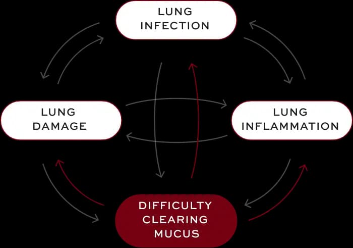Bronchiectasis (BE) interconnected factors—difficulty clearing mucus