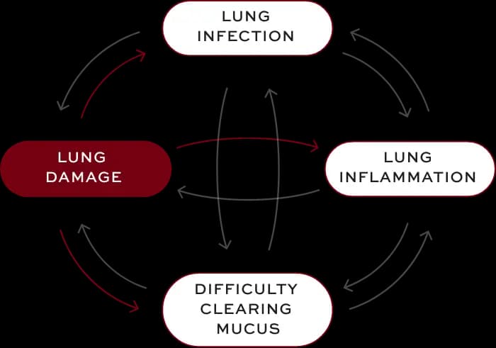 Bronchiectasis (BE) interconnected factors—lung damage